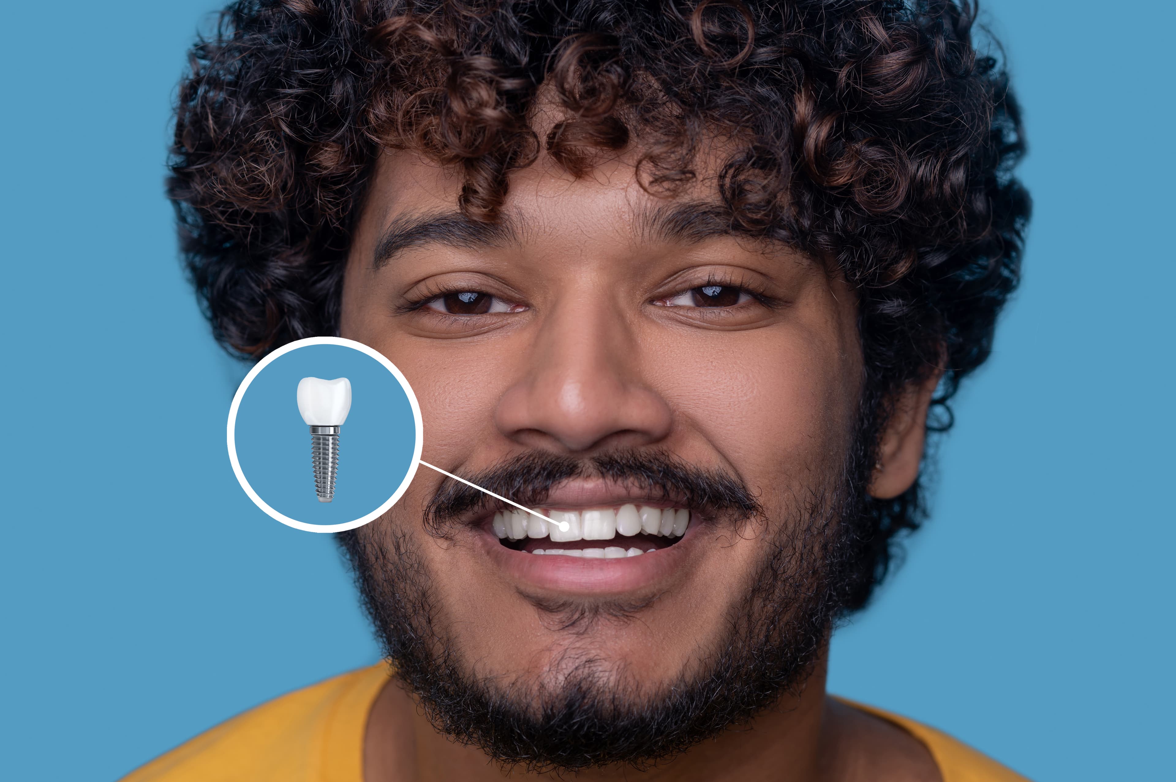 Dental implant consultation and treatment planning