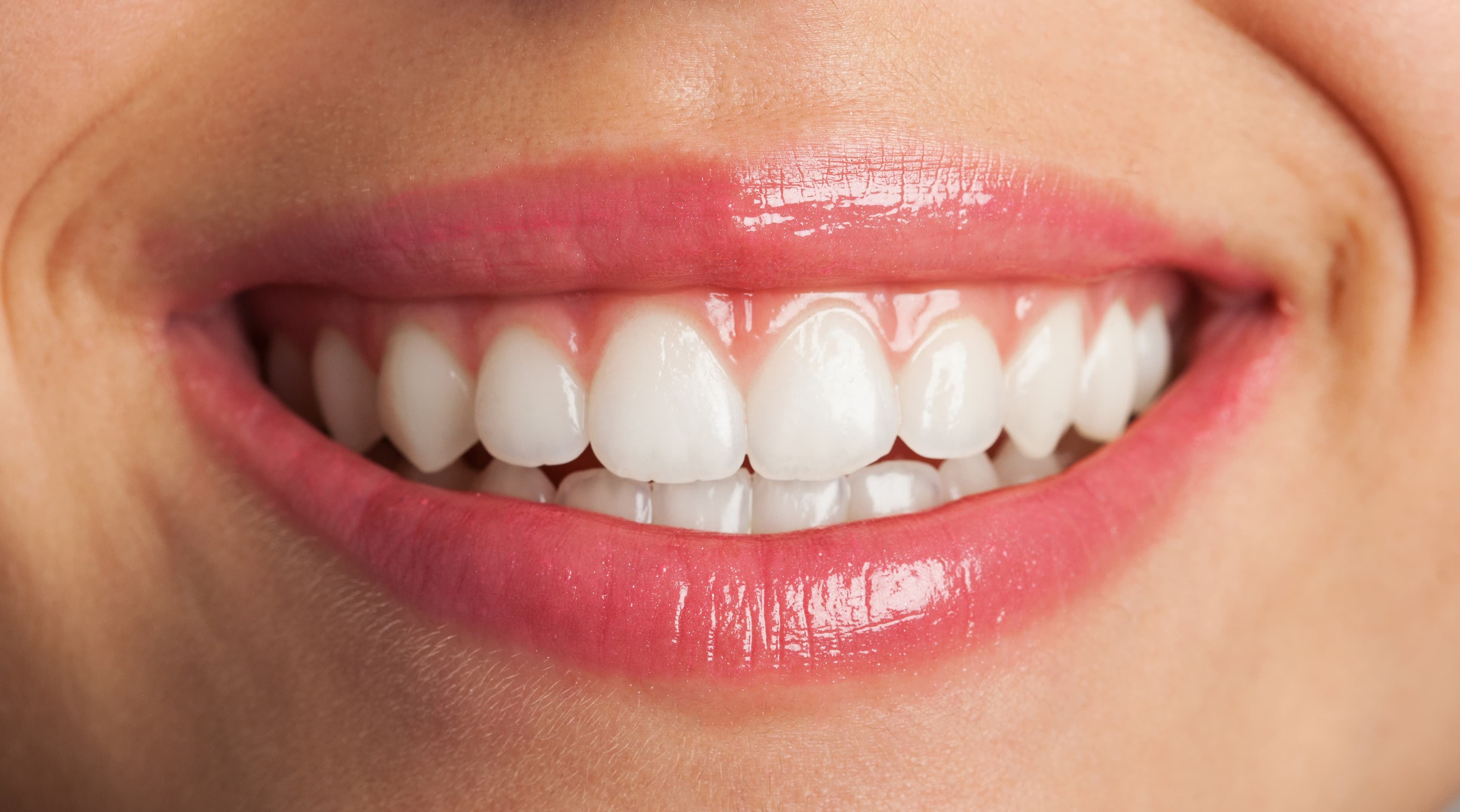 A perfect smile, instantly yours.